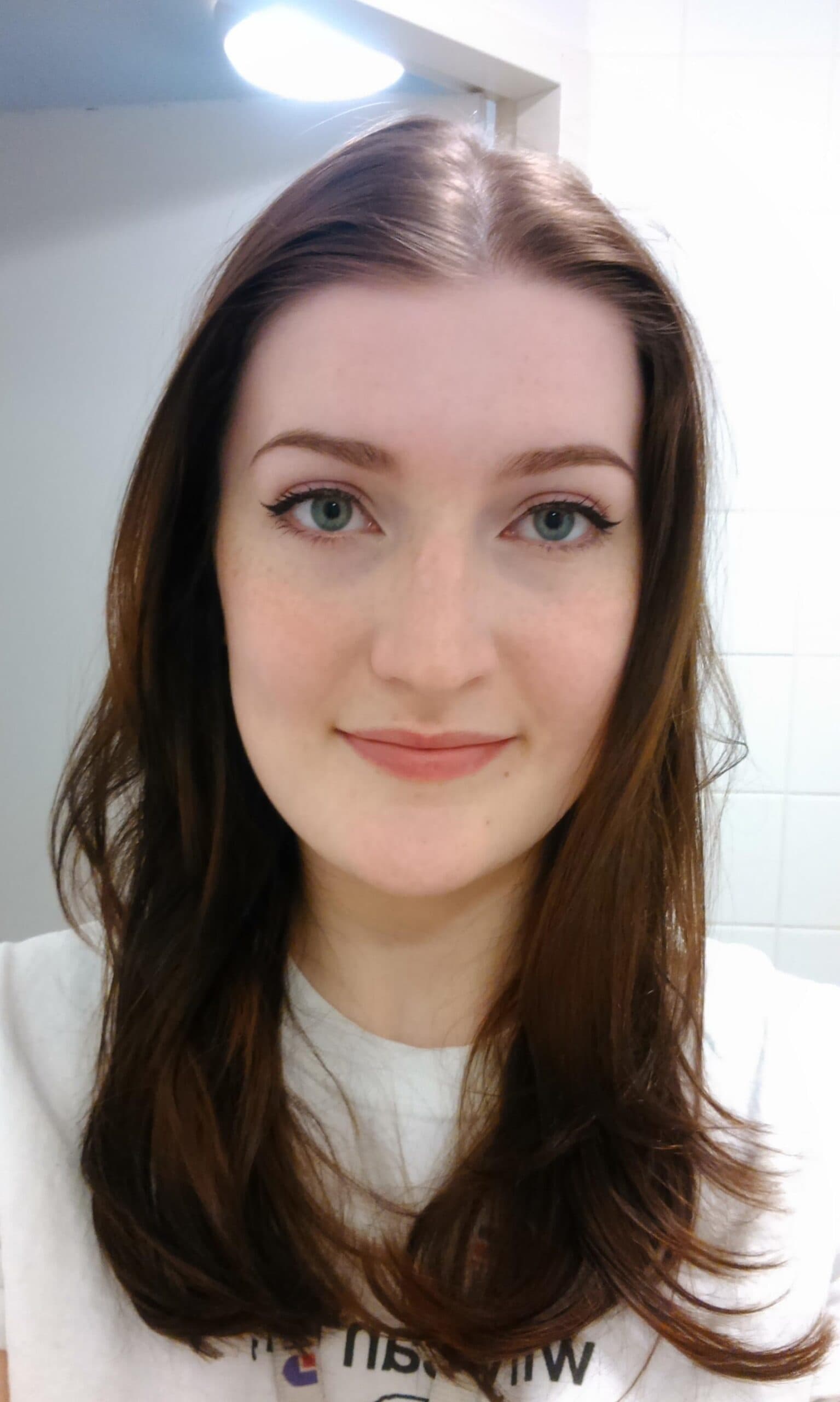 Woman with fine, medium-length brunette hair styled naturally, showing the hair's thin texture and lack of volume.