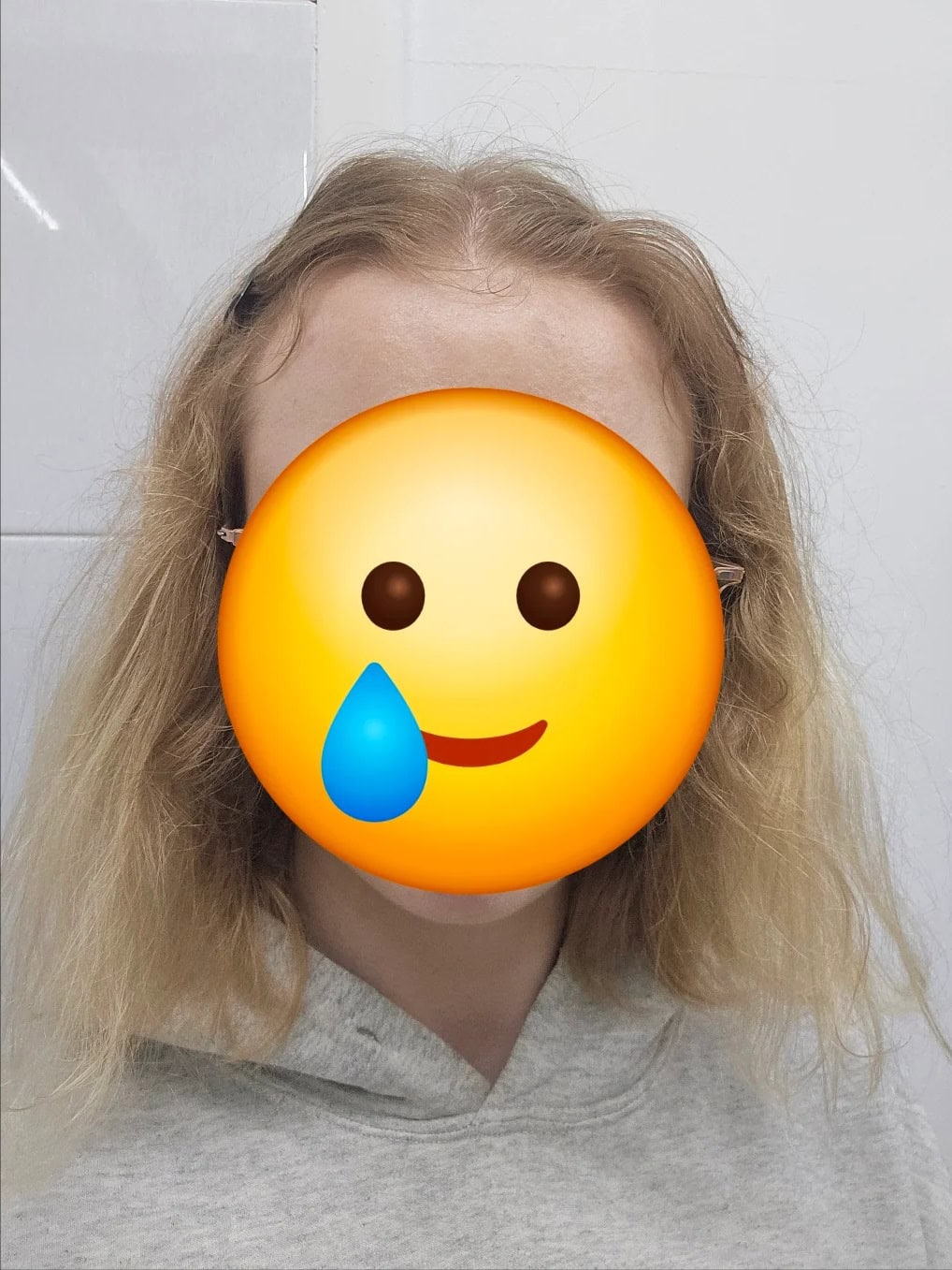 Frontal view of frizzy and dry thin hair showing signs of heat and chemical damage.